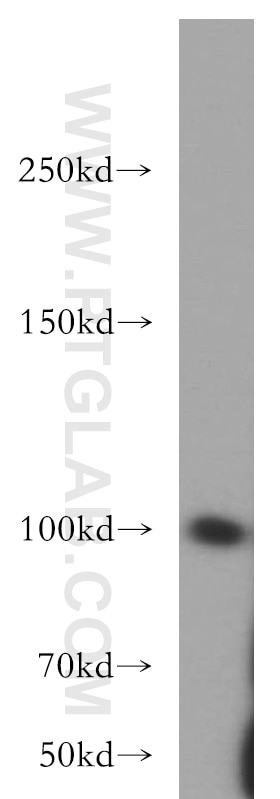 WB analysis of HeLa using 20254-1-AP