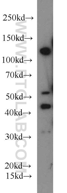 Western Blot (WB) analysis of MCF-7 cells using IGF1R Beta Chain Polyclonal antibody (20254-1-AP)
