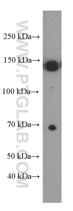 Western Blot (WB) analysis of HeLa cells using IGF1R Beta Chain Monoclonal antibody (66283-1-Ig)