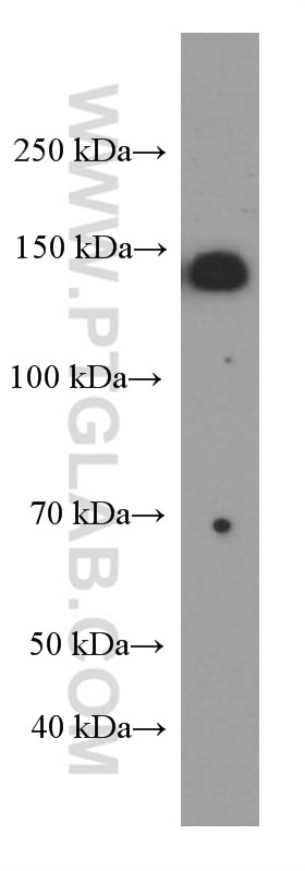 Western Blot (WB) analysis of MCF-7 cells using IGF1R Beta Chain Monoclonal antibody (66283-1-Ig)