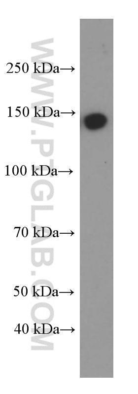 Western Blot (WB) analysis of HUVEC cells using IGF1R Beta Chain Monoclonal antibody (66283-1-Ig)