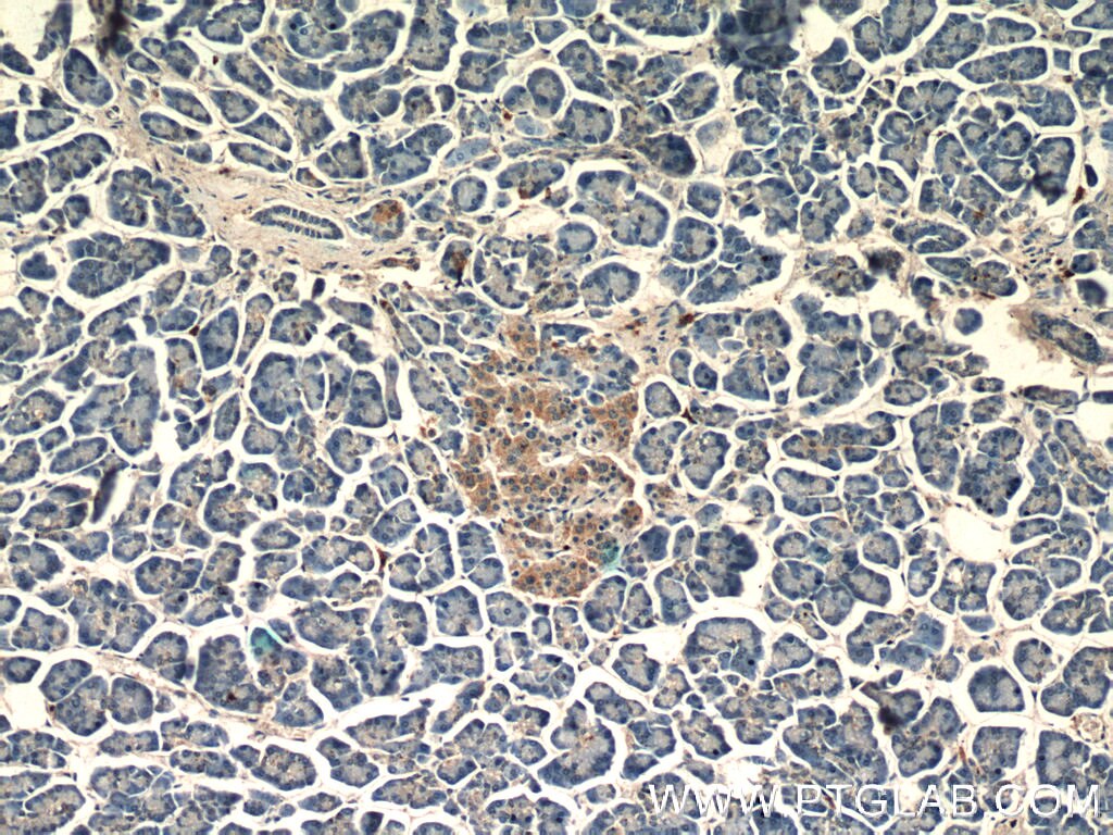 Immunohistochemistry (IHC) staining of human pancreas tissue using IGF2 Polyclonal antibody (24911-1-AP)