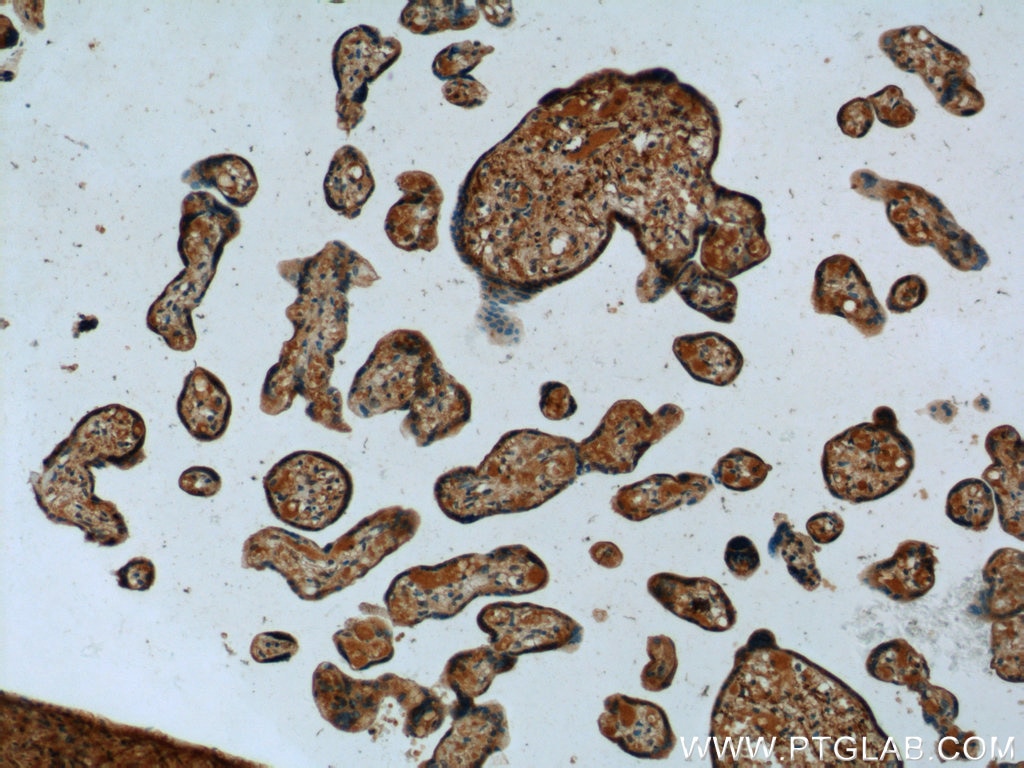 IHC staining of human placenta using 24911-1-AP