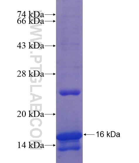IGF2 fusion protein Ag21397 SDS-PAGE