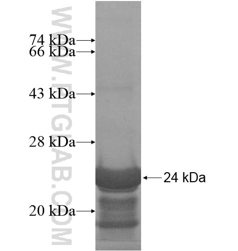 IGF2AS fusion protein Ag15852 SDS-PAGE