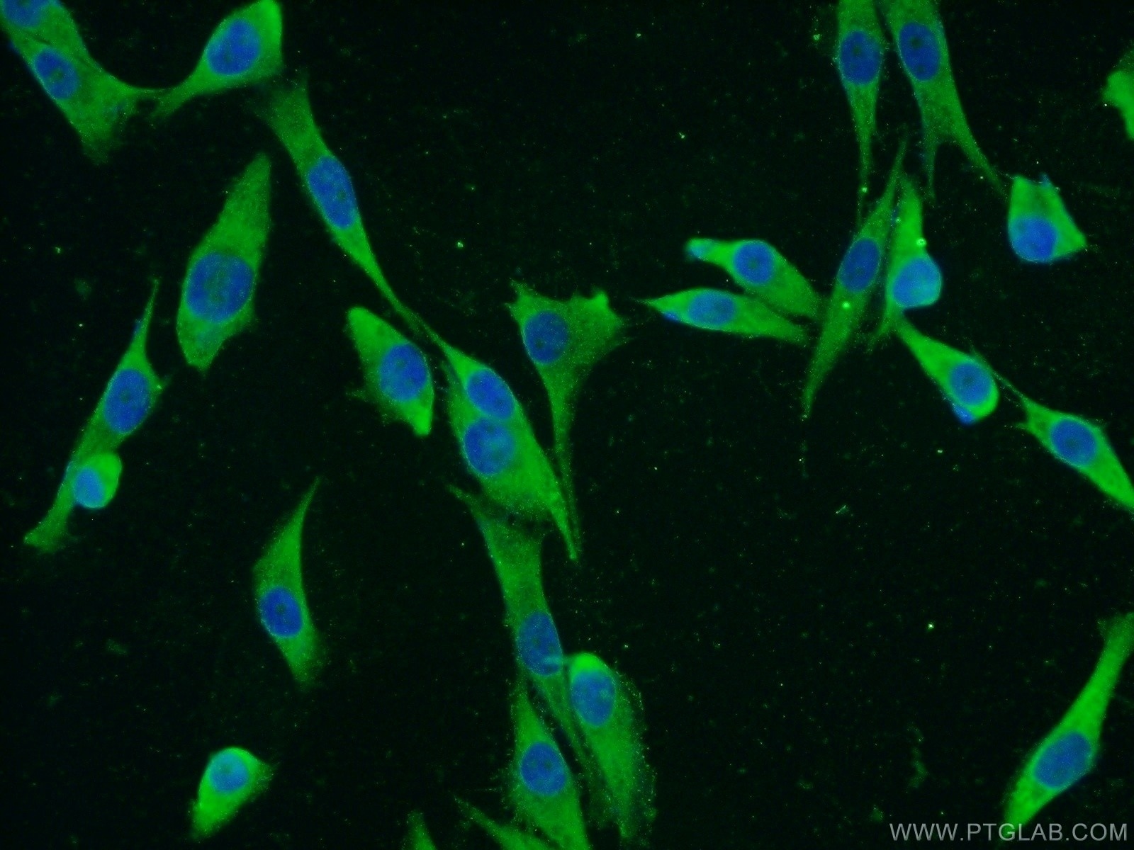 Immunofluorescence (IF) / fluorescent staining of A375 cells using IGF2BP1 Polyclonal antibody (22803-1-AP)