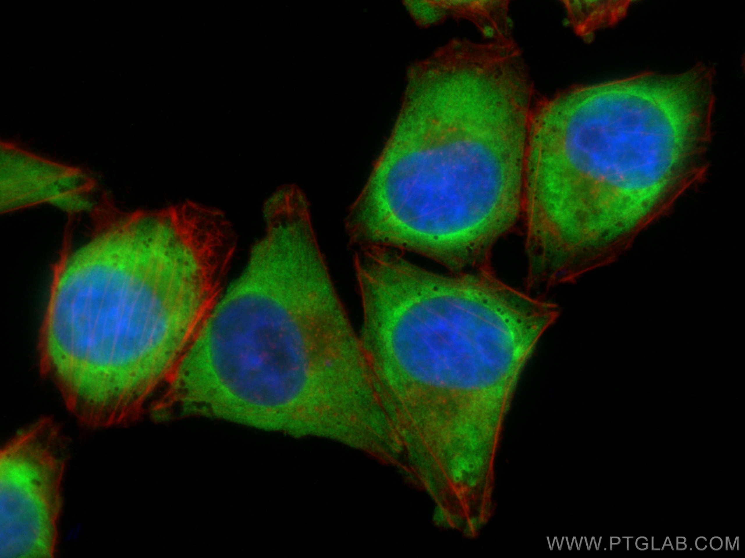 Immunofluorescence (IF) / fluorescent staining of A375 cells using IGF2BP1 Polyclonal antibody (22803-1-AP)