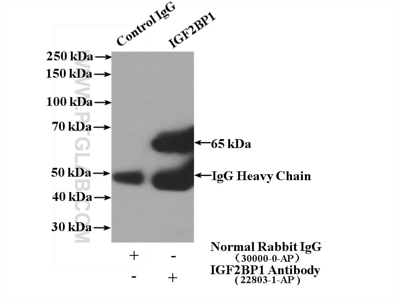 IP experiment of HEK-293 using 22803-1-AP