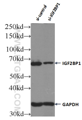 Western Blot (WB) analysis of Jurkat cells using IGF2BP1 Polyclonal antibody (22803-1-AP)