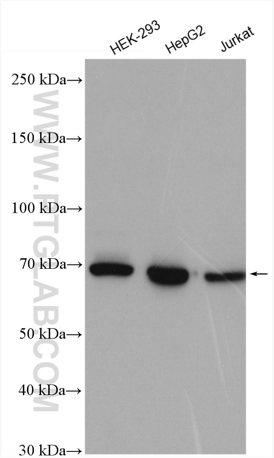 Western Blot (WB) analysis of various lysates using IGF2BP1 Polyclonal antibody (22803-1-AP)