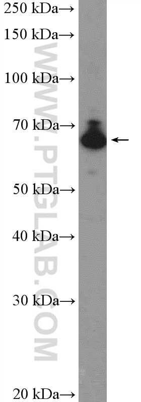 Western Blot (WB) analysis of HepG2 cells using IGF2BP1 Polyclonal antibody (22803-1-AP)