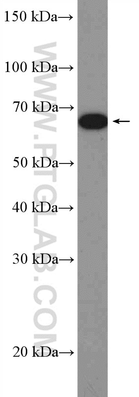 Western Blot (WB) analysis of HuH-7  cells using IGF2BP1 Polyclonal antibody (22803-1-AP)