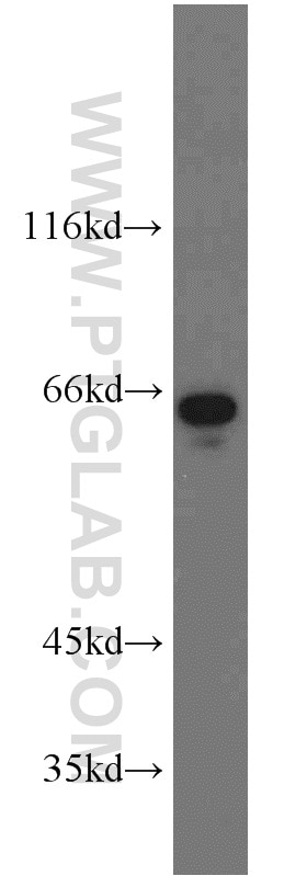 Western Blot (WB) analysis of Jurkat cells using IGF2BP1 Polyclonal antibody (22803-1-AP)