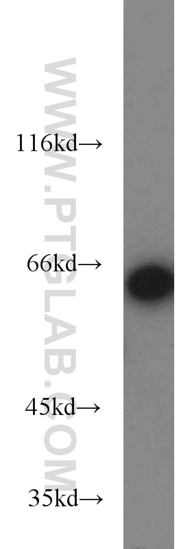 Western Blot (WB) analysis of HEK-293 cells using IGF2BP1 Polyclonal antibody (22803-1-AP)