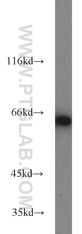 Western Blot (WB) analysis of HEK-293 cells using IGF2BP1 Polyclonal antibody (22803-1-AP)