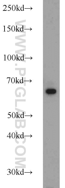 Western Blot (WB) analysis of HEK-293 cells using IGF2BP1 Polyclonal antibody (22803-1-AP)