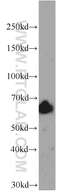 Western Blot (WB) analysis of Jurkat cells using IGF2BP1 Polyclonal antibody (22803-1-AP)