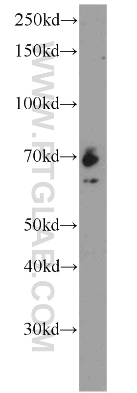 Western Blot (WB) analysis of mouse kidney tissue using IGF2BP1 Polyclonal antibody (22803-1-AP)