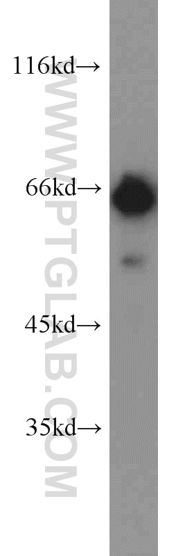 Western Blot (WB) analysis of HEK-293 cells using IGF2BP1 Polyclonal antibody (22803-1-AP)