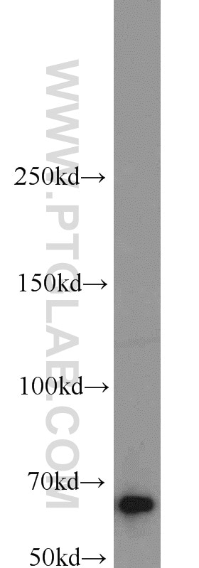 Western Blot (WB) analysis of Jurkat cells using IGF2BP1 Polyclonal antibody (22803-1-AP)