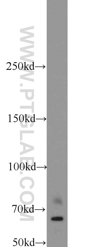 Western Blot (WB) analysis of A375 cells using IGF2BP1 Polyclonal antibody (22803-1-AP)