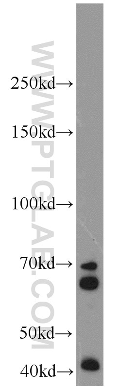 Western Blot (WB) analysis of rat kidney tissue using IGF2BP1 Polyclonal antibody (22803-1-AP)