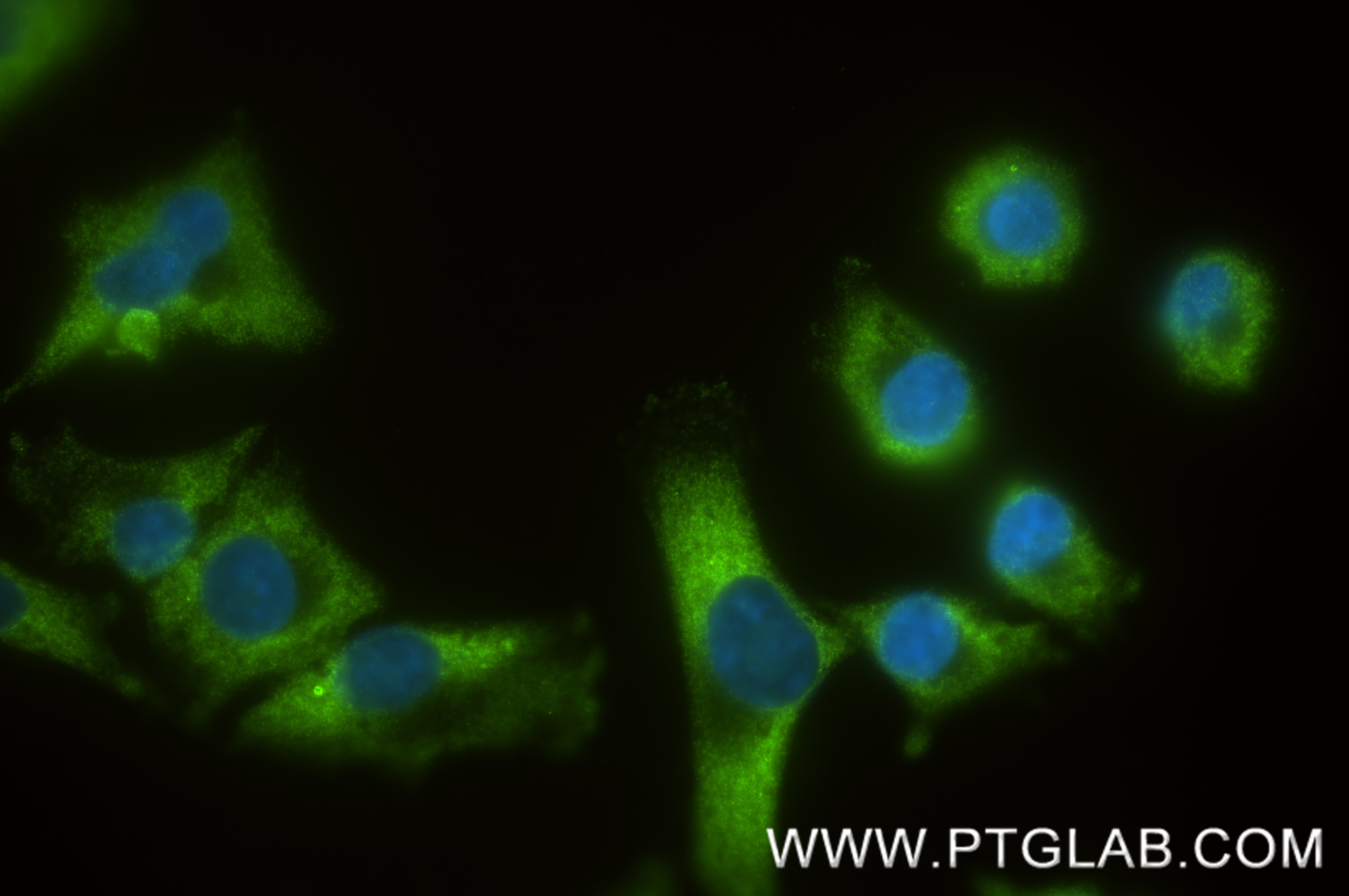 IF Staining of A375 using 88123-1-RR (same clone as 88123-1-PBS) Immunofluorescence (IF) / fluorescent staining of A375 cells using IGF2BP1 Recombinant monoclonal antibody (88123-1-RR)