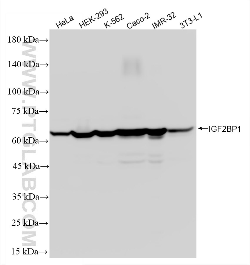 WB analysis using 88123-1-RR (same clone as 88123-1-PBS) Western Blot (WB) analysis of various lysates using IGF2BP1 Recombinant monoclonal antibody (88123-1-RR)