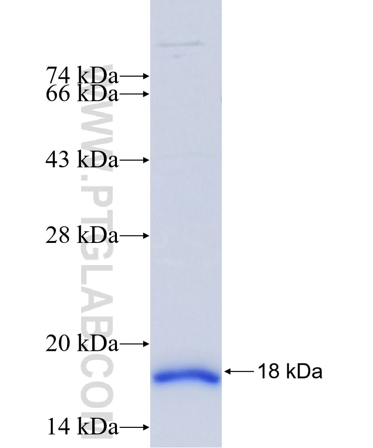 IGF2BP1 fusion protein Ag18686 SDS-PAGE