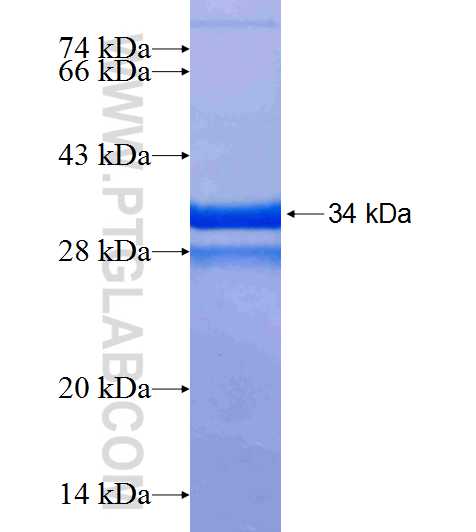 IGF2BP1 fusion protein Ag18859 SDS-PAGE