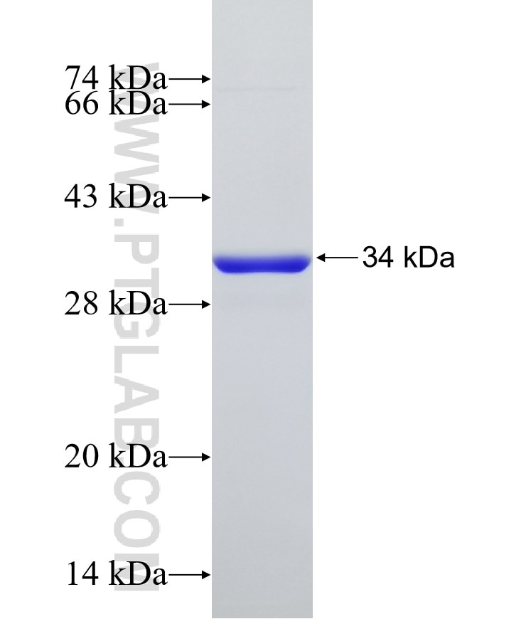 IGF2BP1 fusion protein Ag18859 SDS-PAGE