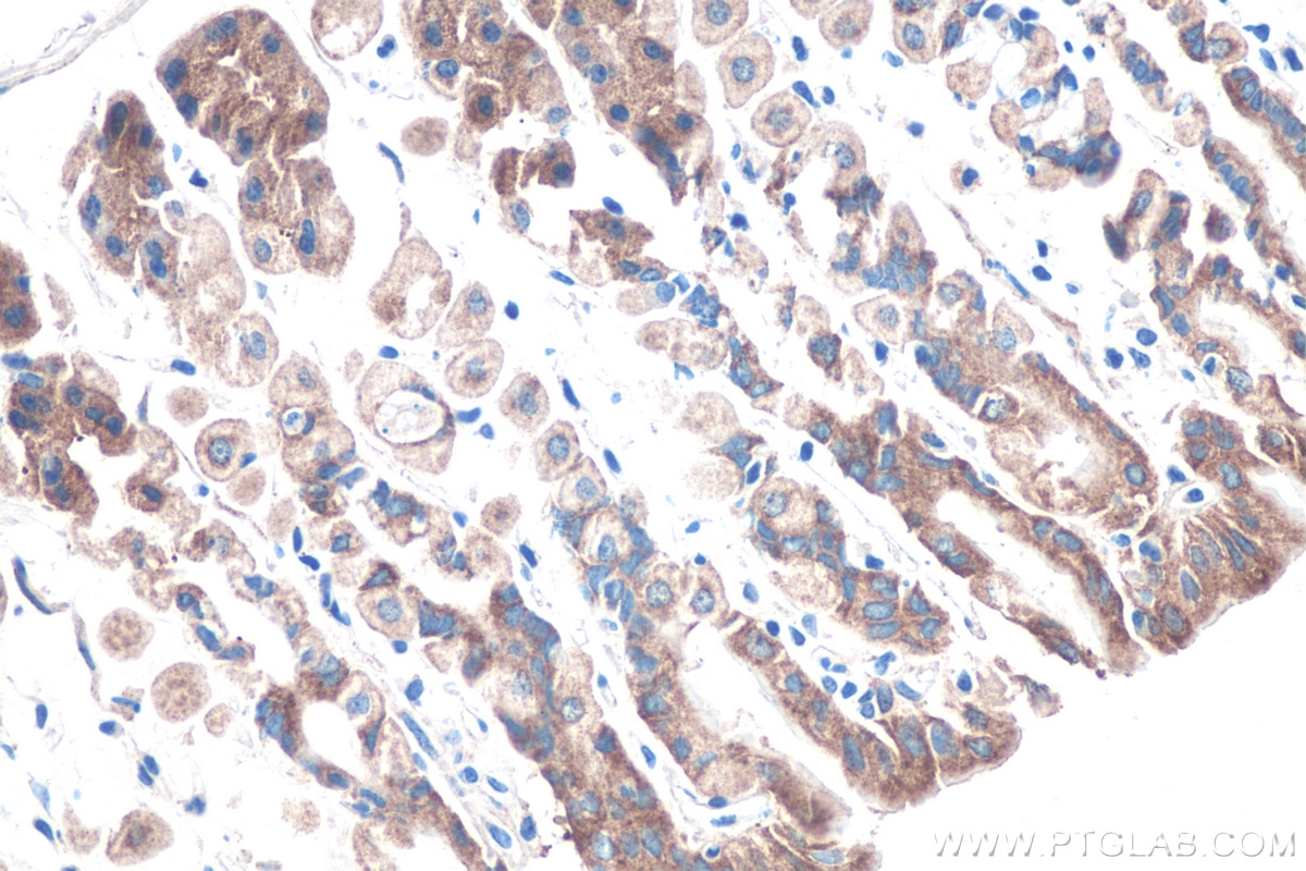 Immunohistochemistry (IHC) staining of mouse stomach tissue using IGF2BP2 Polyclonal antibody (11601-1-AP)