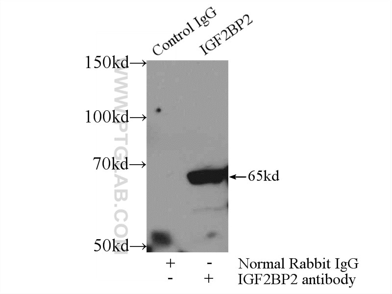 Immunoprecipitation (IP) experiment of HEK-293 cells using IGF2BP2 Polyclonal antibody (11601-1-AP)
