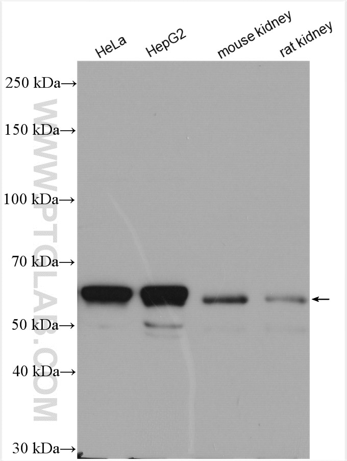 Western Blot (WB) analysis of various lysates using IGF2BP2 Polyclonal antibody (11601-1-AP)