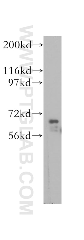 WB analysis of human heart using 11601-1-AP