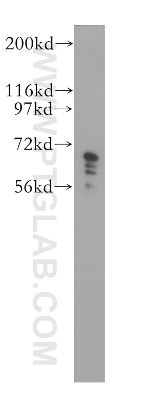 Western Blot (WB) analysis of COLO 320 cells using IGF2BP2 Polyclonal antibody (11601-1-AP)