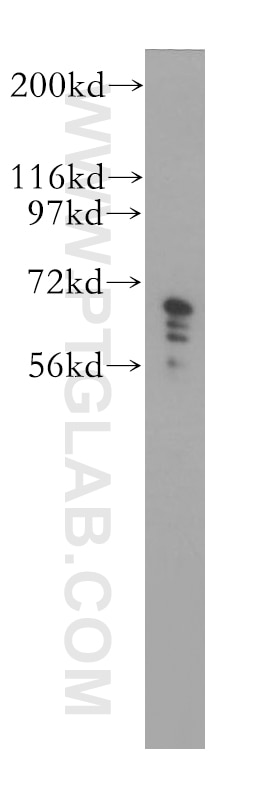 WB analysis of COLO 320 using 11601-1-AP