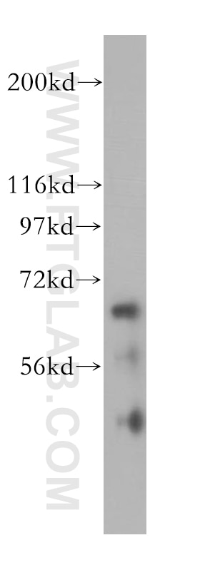 Western Blot (WB) analysis of human kidney tissue using IGF2BP2 Polyclonal antibody (11601-1-AP)