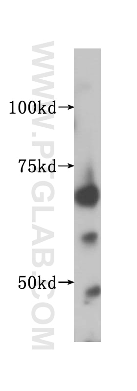 IGF2BP2 Polyclonal antibody