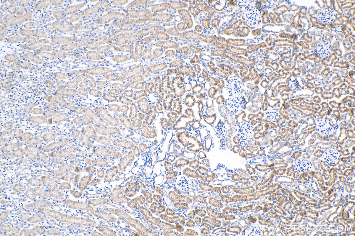 Immunohistochemistry (IHC) staining of mouse kidney tissue using IGF2BP2 Recombinant antibody (82757-2-RR)