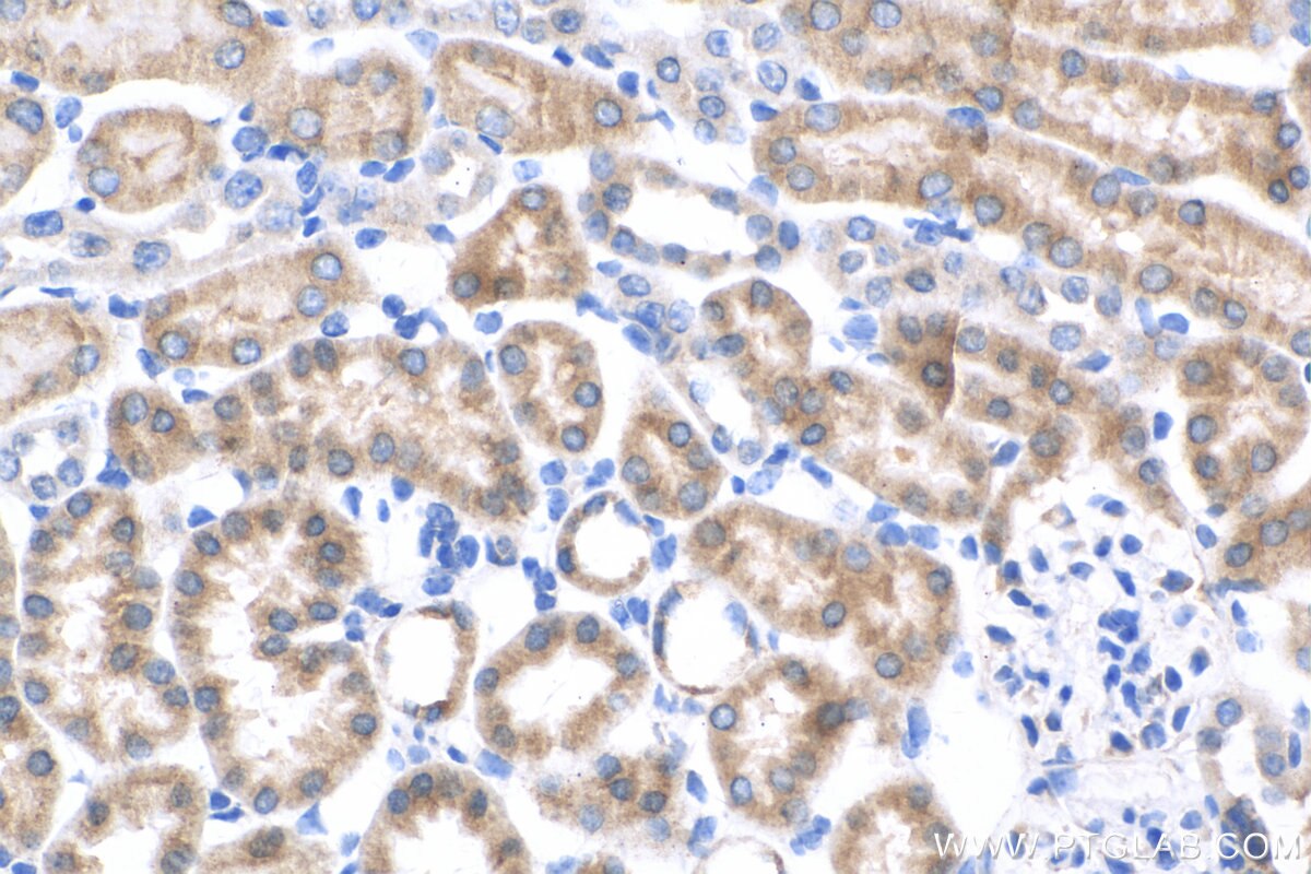 Immunohistochemistry (IHC) staining of mouse kidney tissue using IGF2BP2 Recombinant antibody (82757-2-RR)