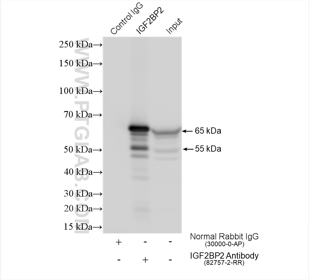 Immunoprecipitation (IP) experiment of HEK-293 cells using IGF2BP2 Recombinant antibody (82757-2-RR)