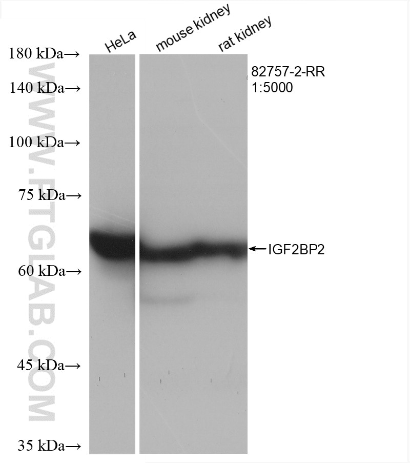 Western Blot (WB) analysis of various lysates using IGF2BP2 Recombinant antibody (82757-2-RR)