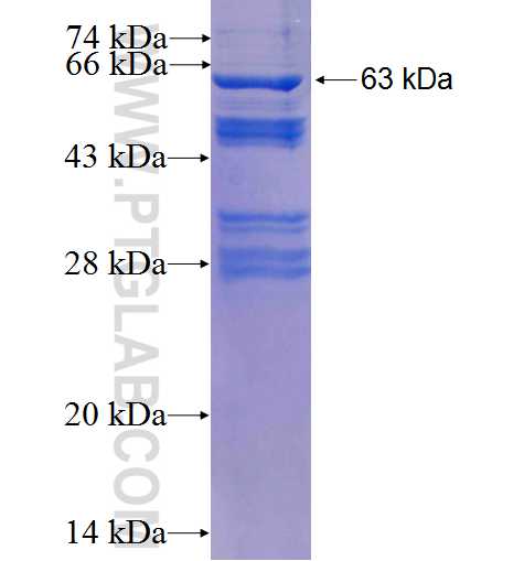 IGF2BP2 fusion protein Ag2142 SDS-PAGE