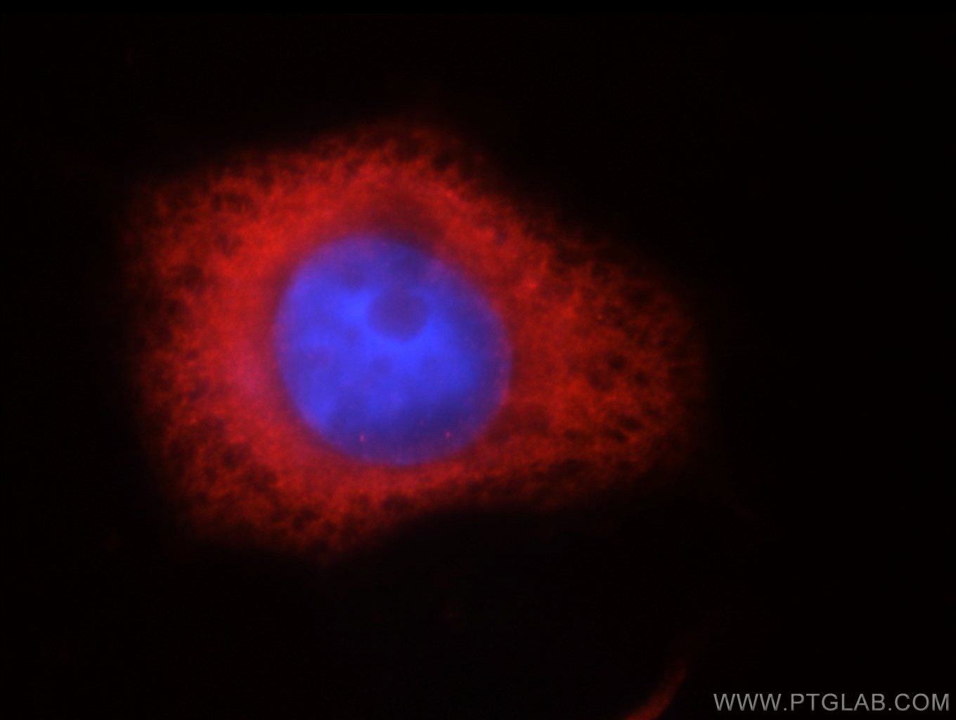 IF Staining of MCF-7 using 14642-1-AP