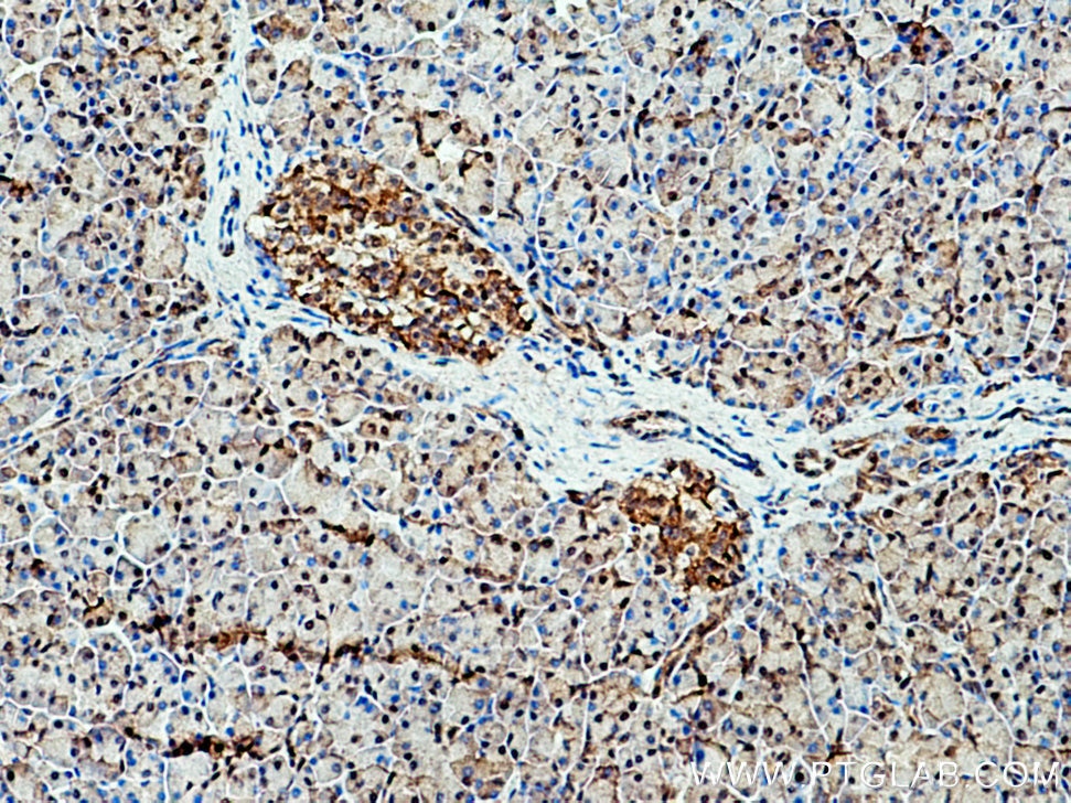 Immunohistochemistry (IHC) staining of human pancreas tissue using IGF2BP3 Polyclonal antibody (14642-1-AP)