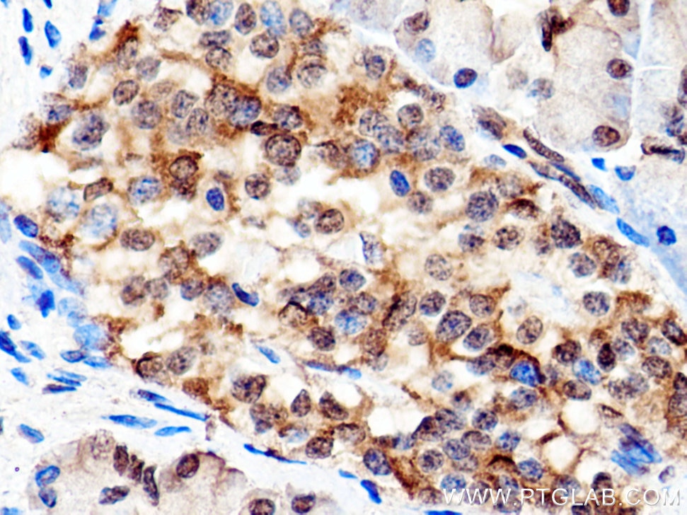 Immunohistochemistry (IHC) staining of human pancreas tissue using IGF2BP3 Polyclonal antibody (14642-1-AP)