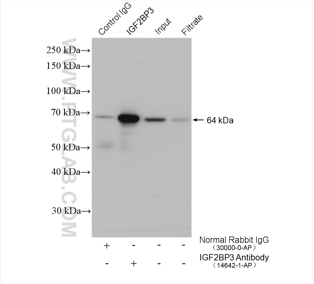 Immunoprecipitation (IP) experiment of HEK-293 cells using IGF2BP3 Polyclonal antibody (14642-1-AP)