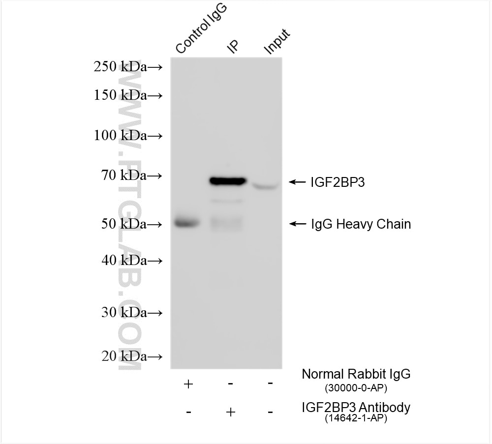 Immunoprecipitation (IP) experiment of HEK-293 cells using IGF2BP3 Polyclonal antibody (14642-1-AP)