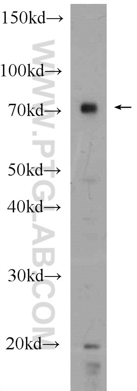 Western Blot (WB) analysis of mouse brain tissue using IGF2BP3 Polyclonal antibody (14642-1-AP)